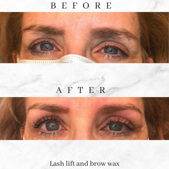 Get Attractive Look With Lash Lift Treatment In Vancouver